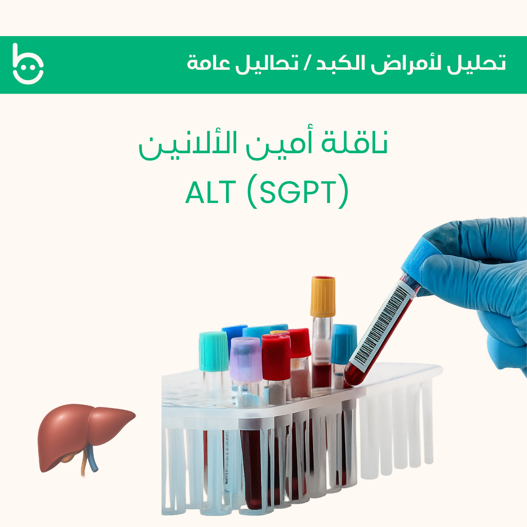 ناقلة أمين الألانين / ALТ (SGРT)